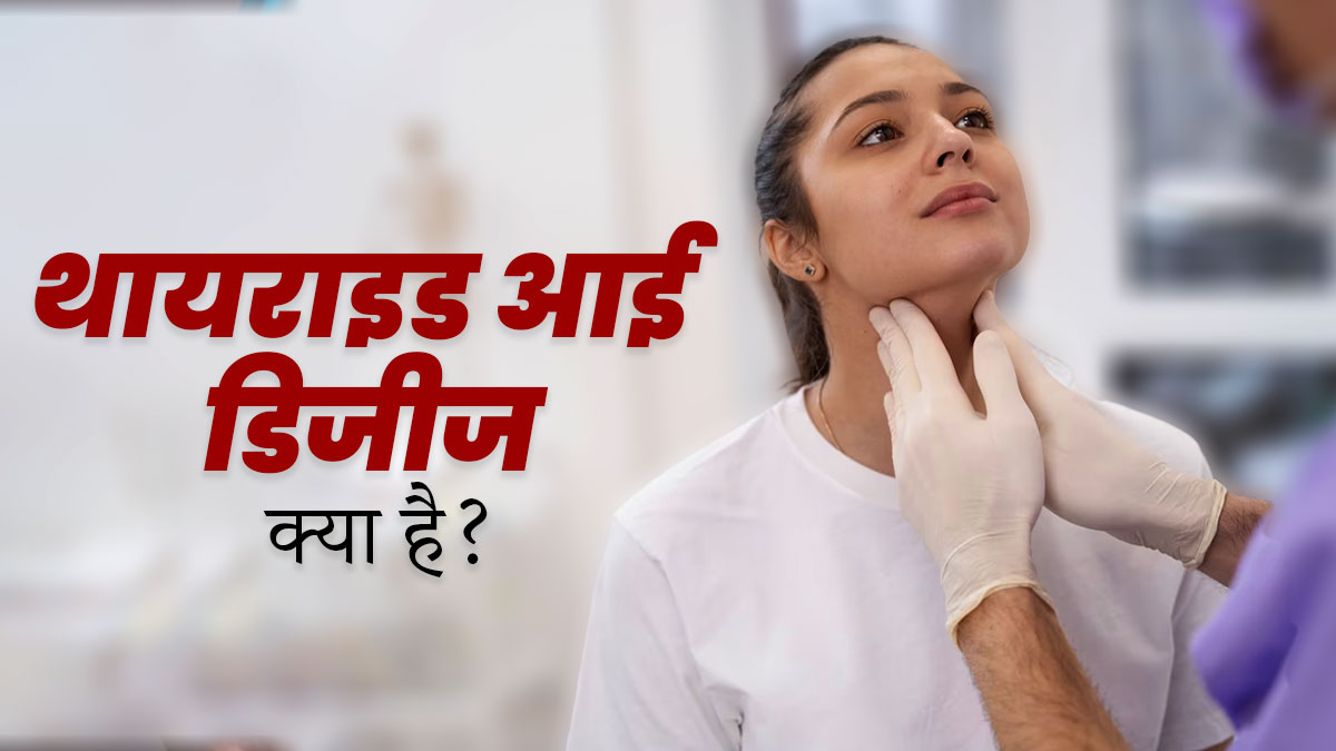 थायराइड आई डिजीज क्या है? डॉक्टर से जानें लक्षण, कारण और बचाव