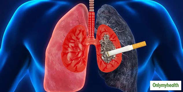Study Reveals Tobacco Contributes To Rising Cases Of Cancer In India