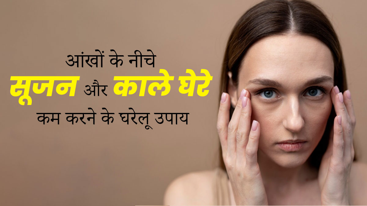 सर्दियों में आंखों के नीचे की सूजन और काले घेरे कम करने के लिए अपनाएं ये 4 घरेलू नुस्खे, दूर होगी समस्या