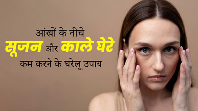 सर्दियों में आंखों के नीचे की सूजन और काले घेरे कम करने के लिए अपनाएं ये 4 घरेलू नुस्खे, दूर होगी समस्या