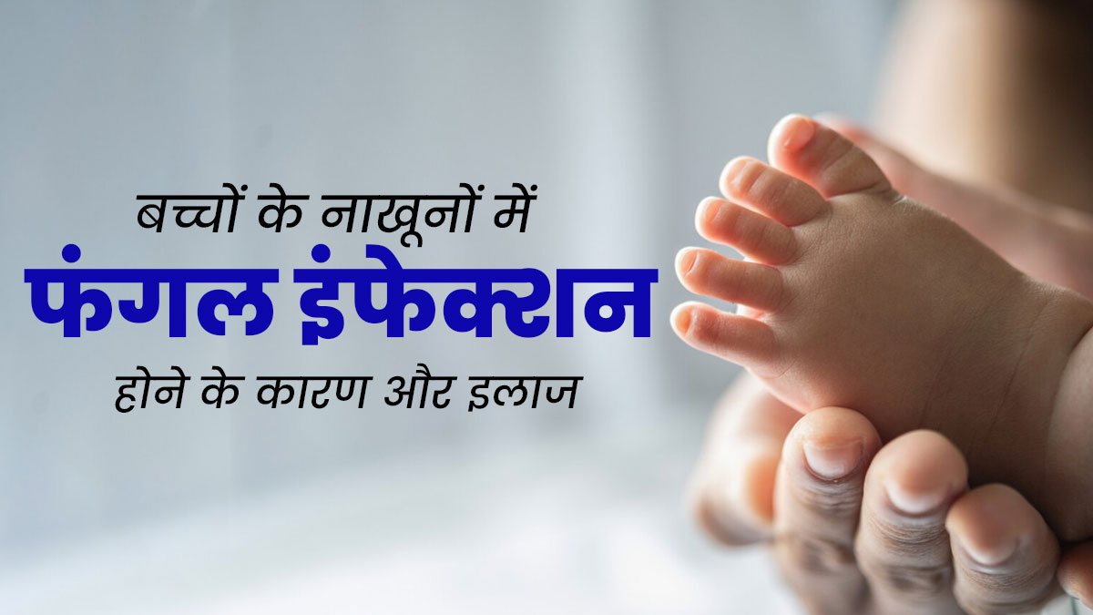 बच्चों के नाखूनों में फंगल इंफेक्शन क्यों हो जाता है? जानें कारण और इलाज