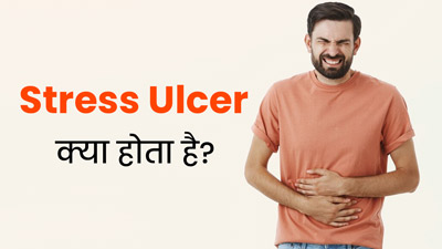 क्या होता है Stress Ulcer? डॉक्टर से जानें इसके लक्षण और इलाज