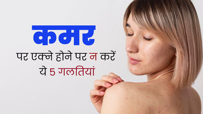 कमर पर एक्ने हो गए हैं तो भूलकर भी न करें ये 5 गलतियां, बढ़ सकती है परेशानी
