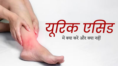 हाई यूरिक एसिड और गाउट से परेशान हैं, तो एक्सपर्ट से जानें क्या करें और क्या नहीं?