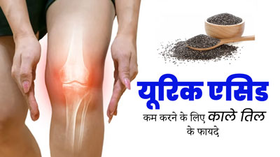 यूरिक एसिड कम करने के लिए करें काले तिल का सेवन, मिलेंगे जबरदस्त फायदे