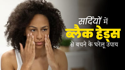 सर्दियों में नाक के आस-पास ब्लैकहेड्स होने का कारण और इनसे बचने का घरेलू उपाय