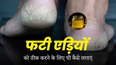 फटी एड़ियों का इलाज है देसी घी, एक्सपर्ट से जानें इस्तेमाल का सही तरीका