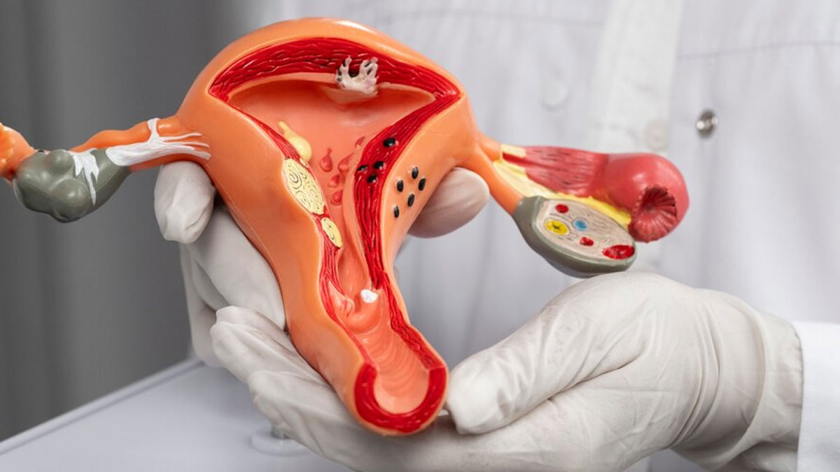 What is thin endometrium and how can be it be treated with Regenerative Medicine