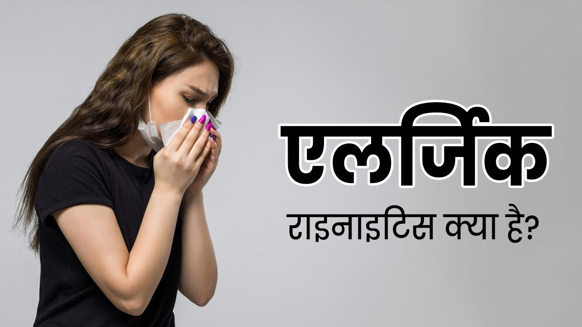 एलर्जिक राइनाइटिस क्या है? जानें इसके कारण, लक्षण और बचाव