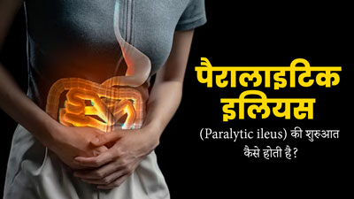 Paralytic ileus: पैरालाइटिक इलियस के कारण आंतों में आ जाती है रुकावट, जानें कैसे शुरू होती है यह बीमारी?