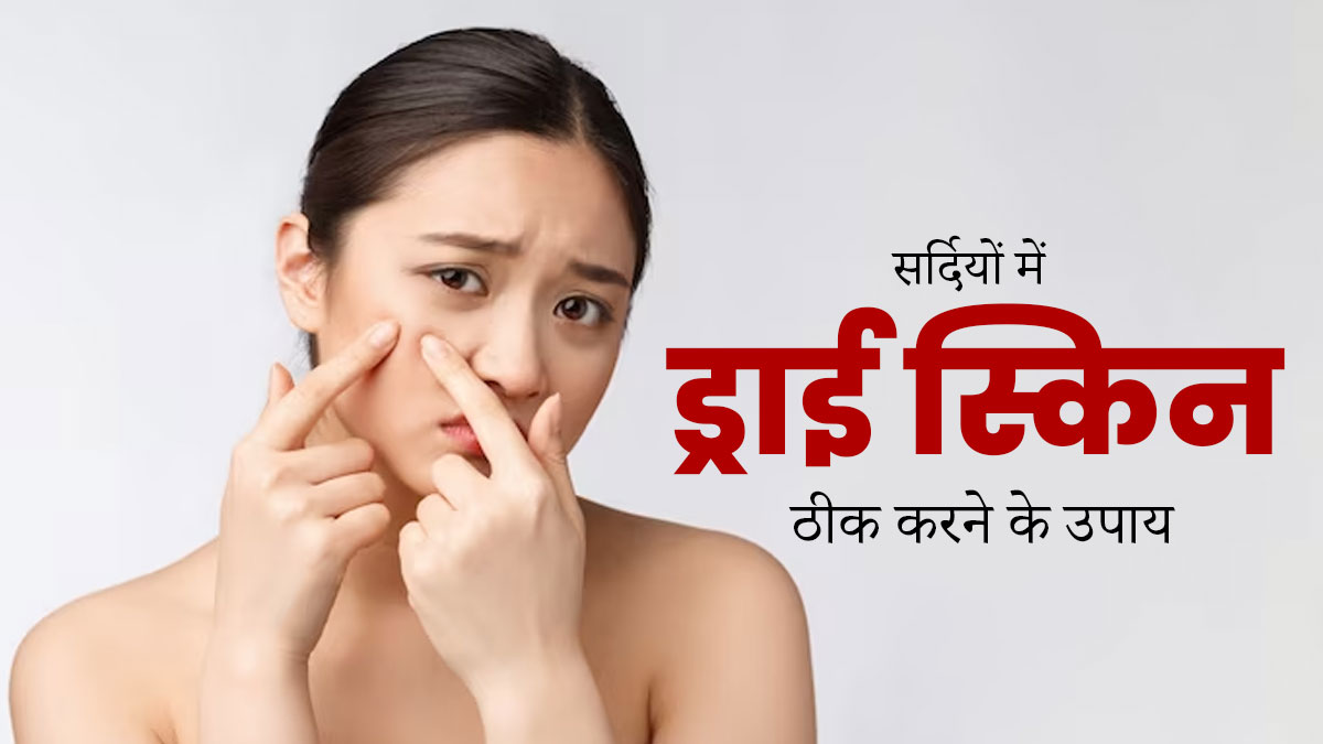 सर्दियों में ड्राई स्किन ठीक करने के लिए फॉलो करें ये टिप्स, त्वचा बनेगी मुलायम