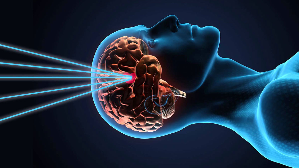 gamma knife surgery