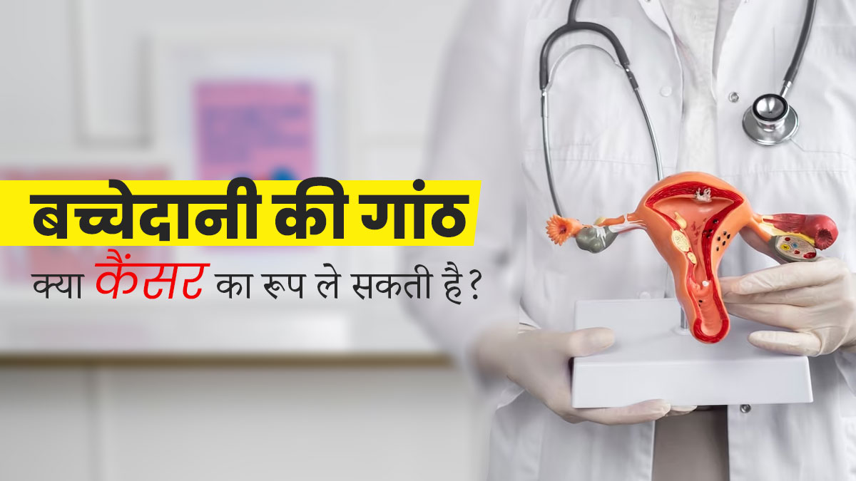क्या बच्चेदानी की गांठ कैंसर का रूप ले सकती है? जानें कैसे कराएं इसका इलाज