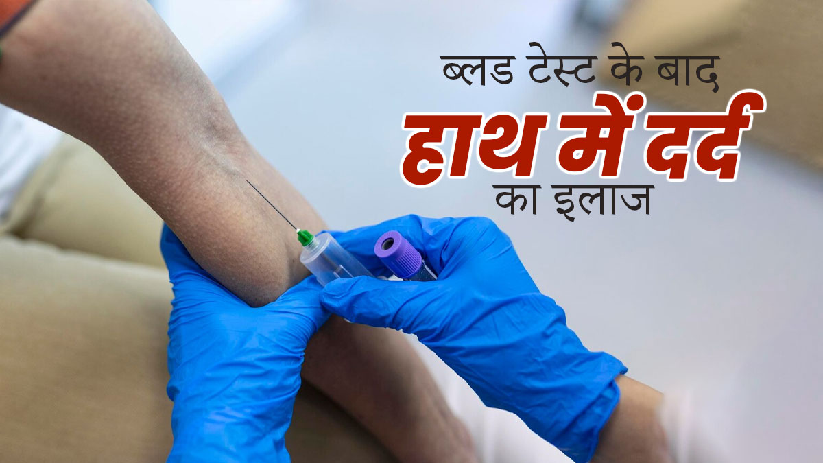 ब्‍लड टेस्‍ट के बाद होता है हाथ में दर्द, तो राहत के ल‍िए अपनाएं ये आसान उपाय