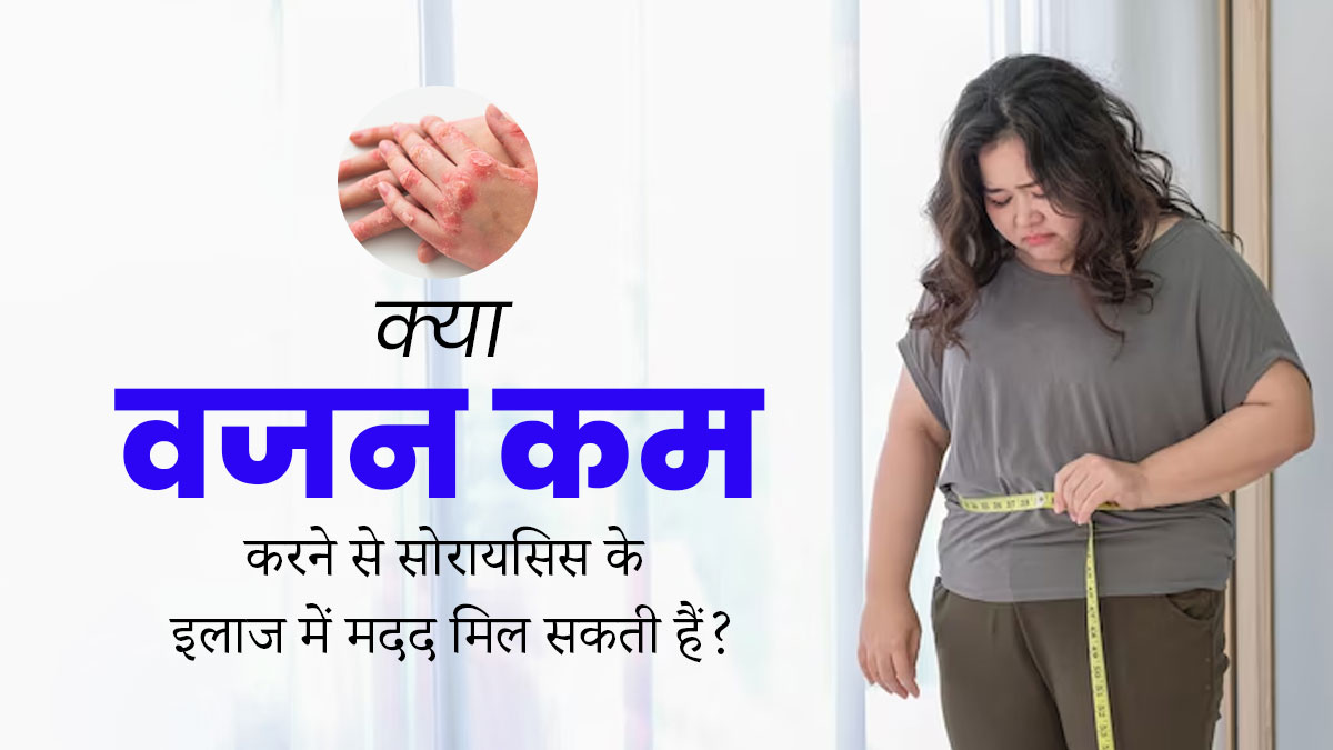 क्या वजन कम करने से सोरायसिस के इलाज में मदद मिल सकती है? जानें डॉक्टर से 