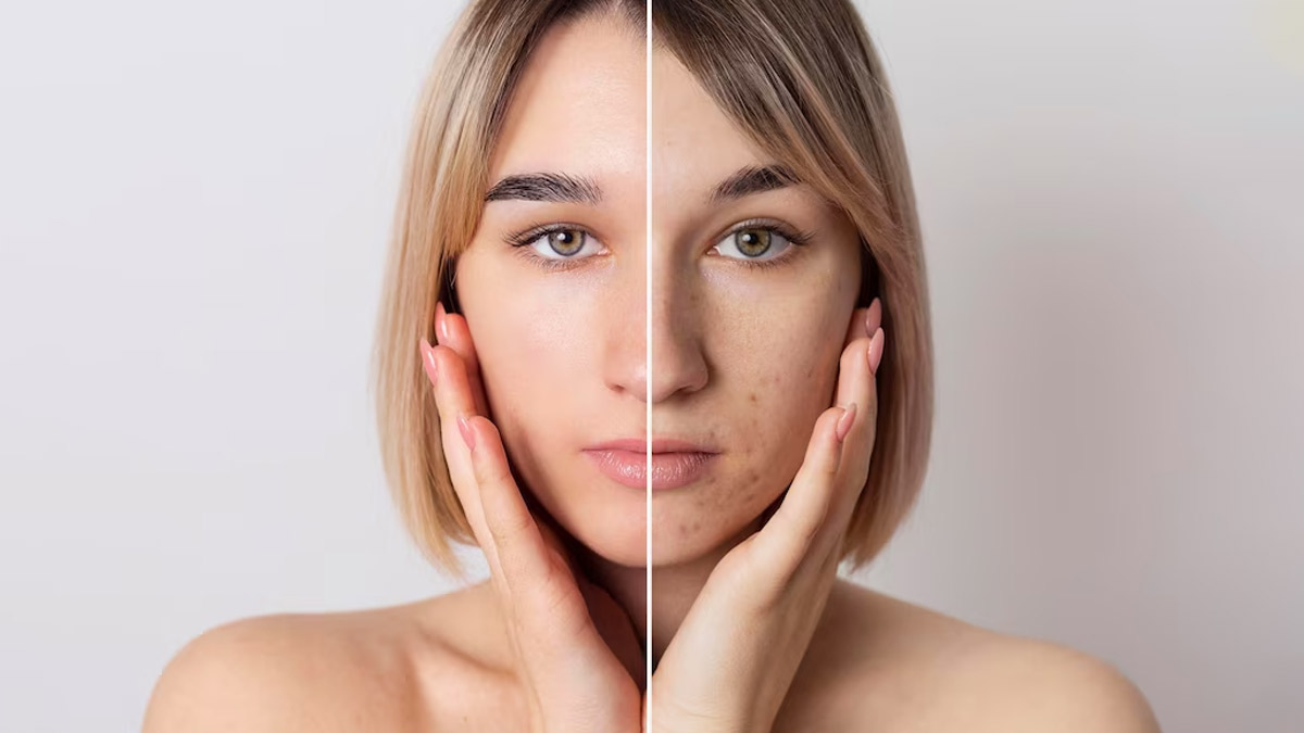 How Excessive Drinking Takes a Toll on Your Skin Health