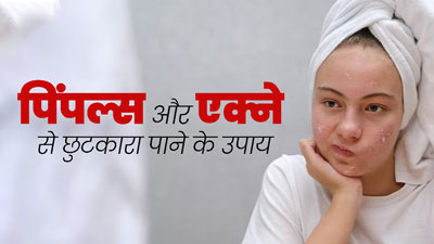 पिंपल्स से छुटकारा पाने के लिए सौंफ में मिलाकर पिएं ये 3 चीजें, मिलेंगे कई फायदे
