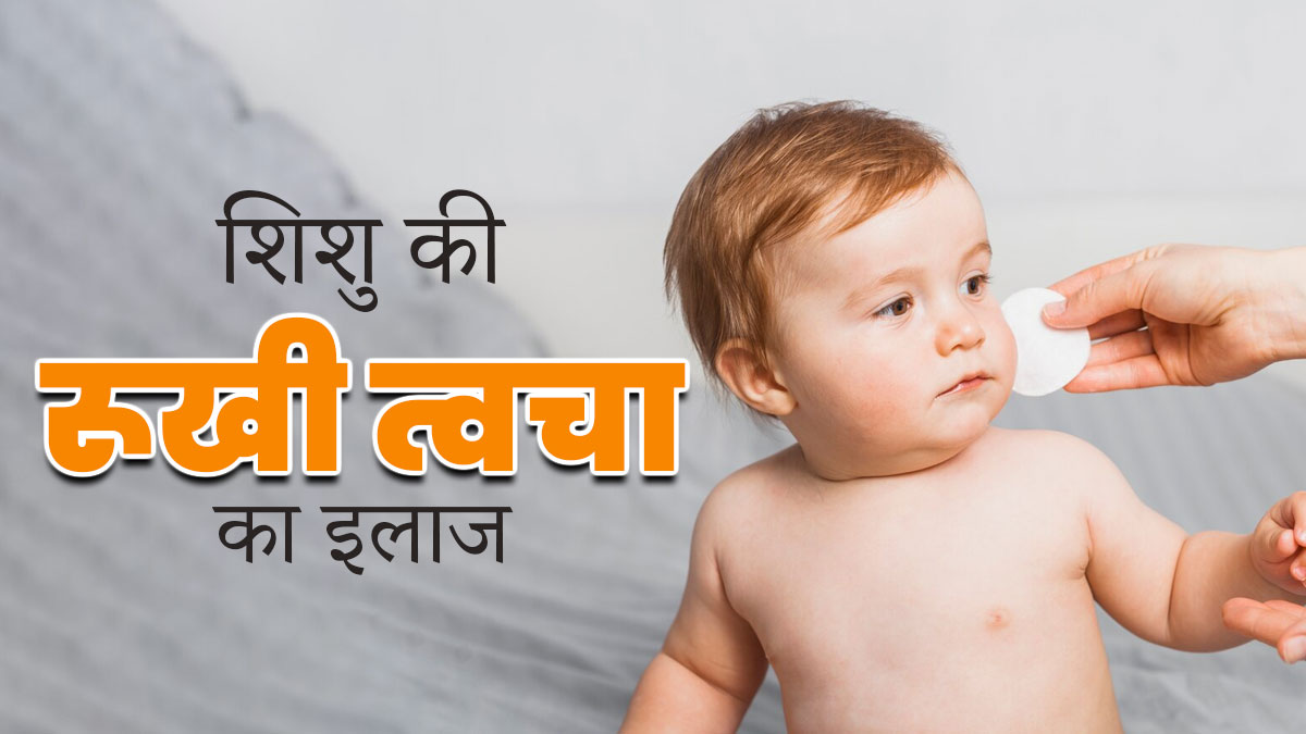 शिशु की रूखी त्वचा को दूर करने के ल‍िए सर्दि‍यों में अपनाएं ये 5 ट‍िप्‍स  