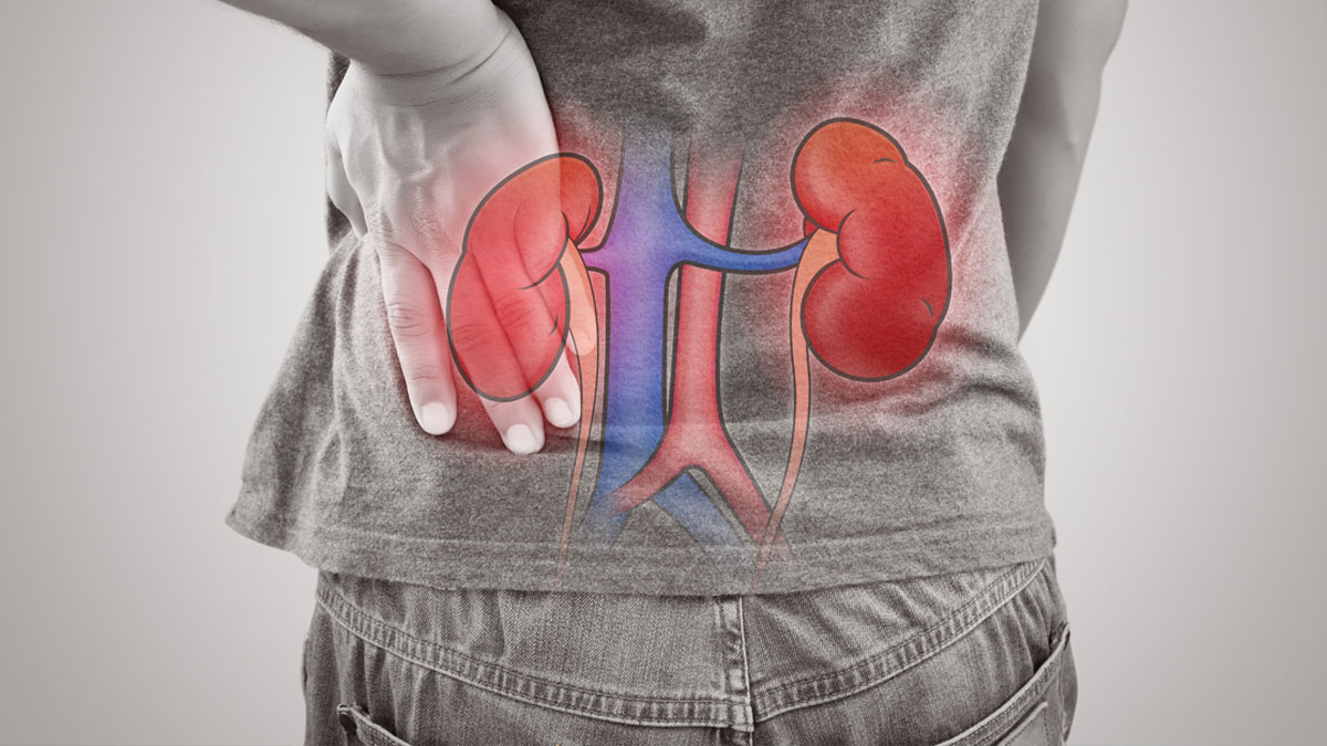 kidney cyst