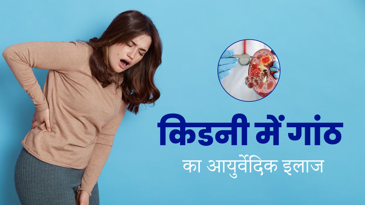 आयुर्वेद में किडनी की गांठ (सिस्ट) का इलाज कैसे किया जाता है? जानें आयुर्वेदाचार्य से