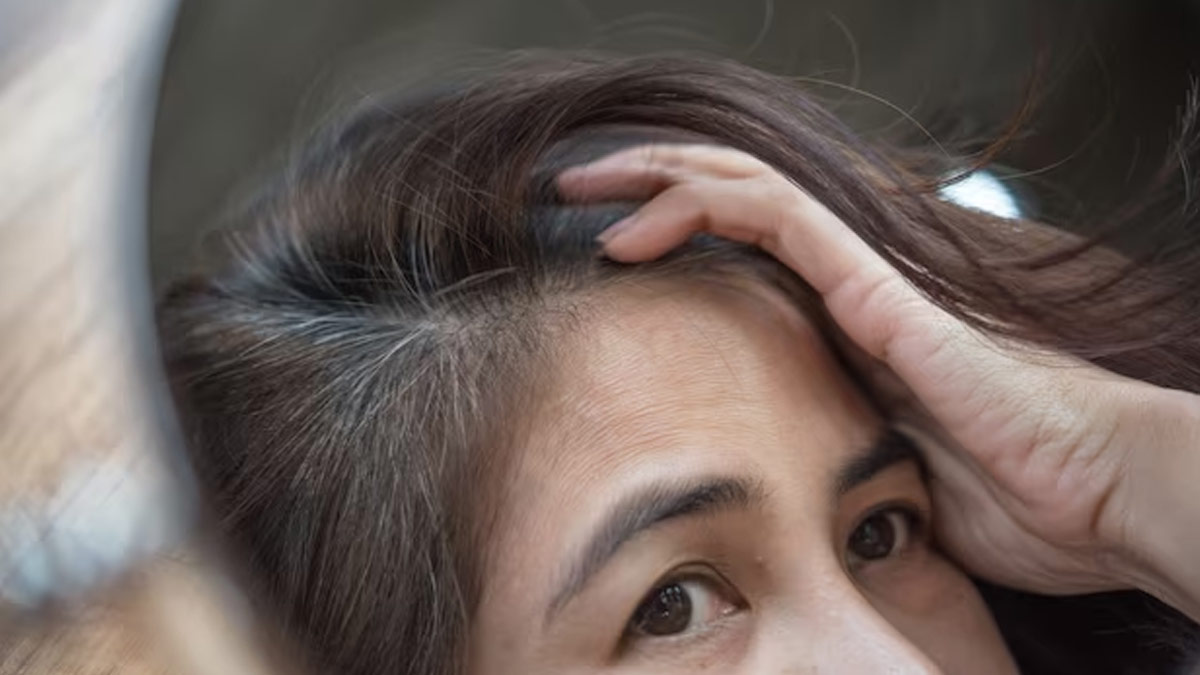 Have A Family History Of Premature Greying? Then You Must Eat These Superfoods