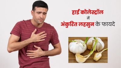 हाई कोलेस्ट्रॉल में करें अंकुरित लहसुन का सेवन, जानें सही तरीका