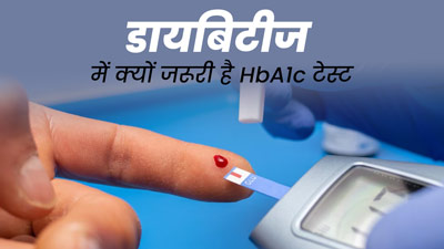 डायबिटीज है तो जरूर कराएं HbA1c टेस्ट, एक्सपर्ट ने बताया क्यों है जरूरी