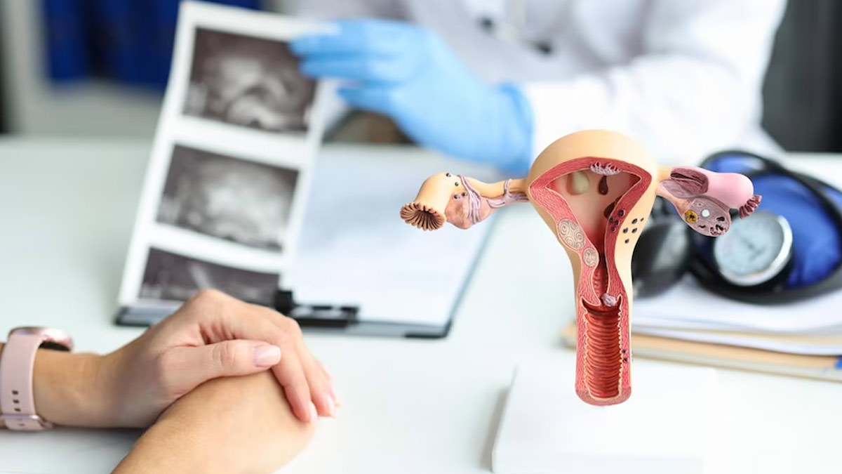 Does A Pap Smear Hurt? And 3 Other Facts To Know About The Procedure |  OnlyMyHealth