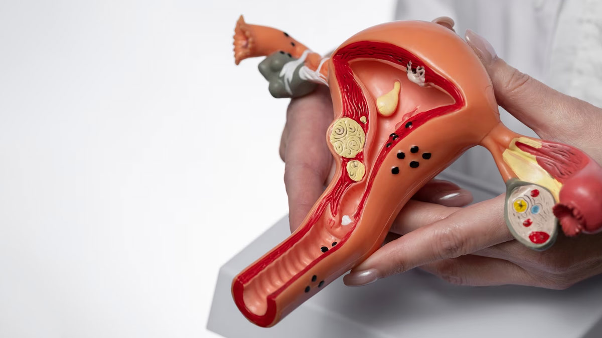 Who Is Most At Risk For Pelvic Inflammatory Disease In Hindi 