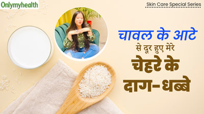 दाग-धब्बों ने छीन ली थी जोश‍िता के चेहरे की रंगत, मम्मी ने बोला चावल का आटा लगाओ और फ‍िर मिली बेदाग त्वचा