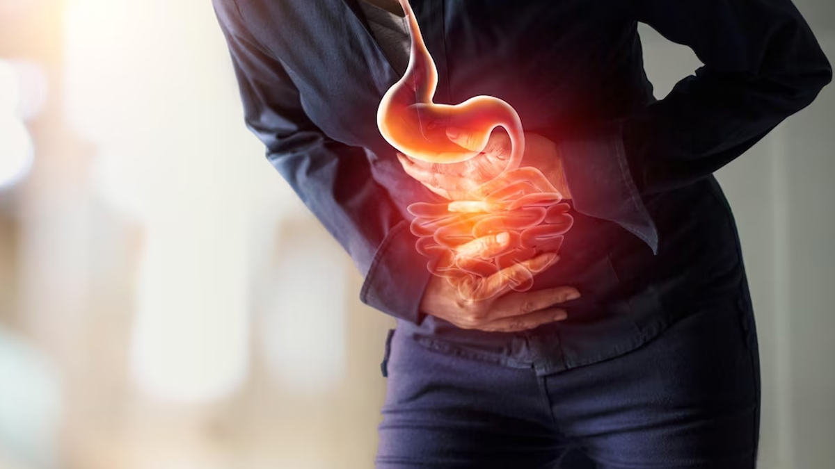 Irritable Bowel Syndrome VS Inflammatory Bowel Disease: Expert Explains ...