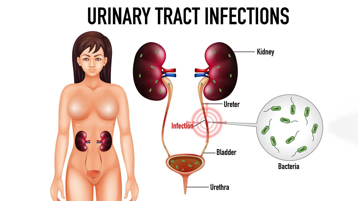Common Causes Of Urinary Tract Infection UTI In Hindi