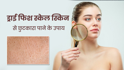 Dry Fish Scale Skin: सर्दियों में स्किन हो जाती है रूखी, तो जानें ड्राई फिश स्केल स्किन से राहत पाने के 8 उपाय