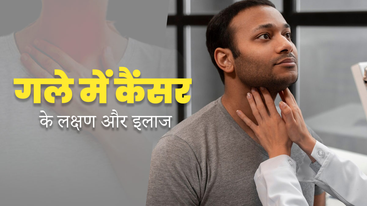 लगातार खांसी हो सकती है गले के कैंसर का एक लक्षण, डॉक्टर से जानें बचाव के तरीके