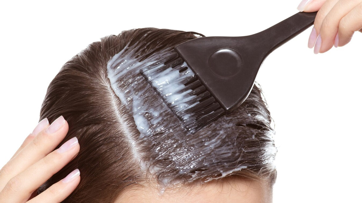 dandruff