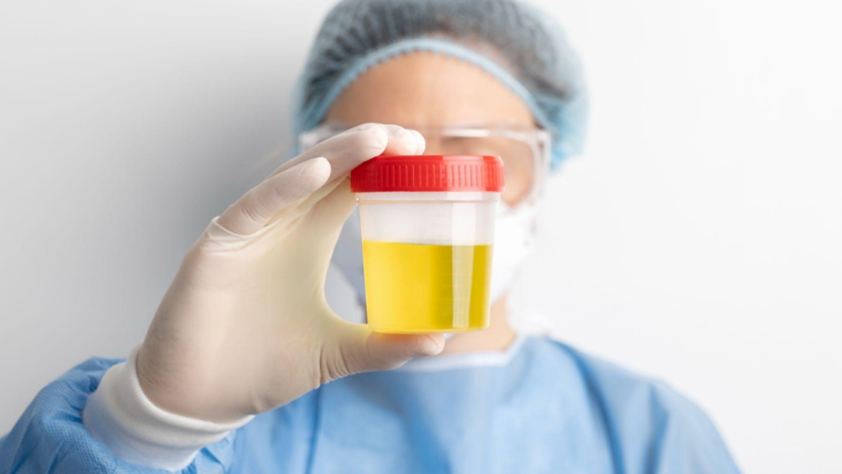Best Synthetic Urine Kits: Top 5 Fake Pee Brands To Pass A Drug Test |  OnlyMyHealth