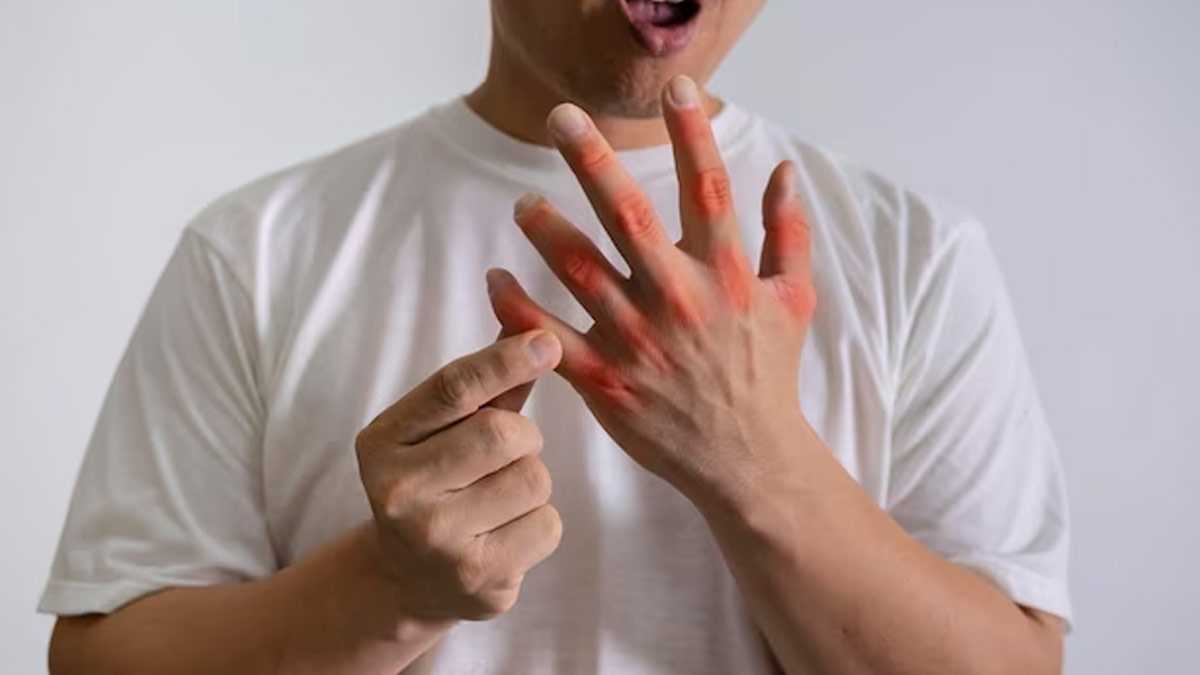 causes of swollen fingers in winter expert tips to reduce swelling in hindi