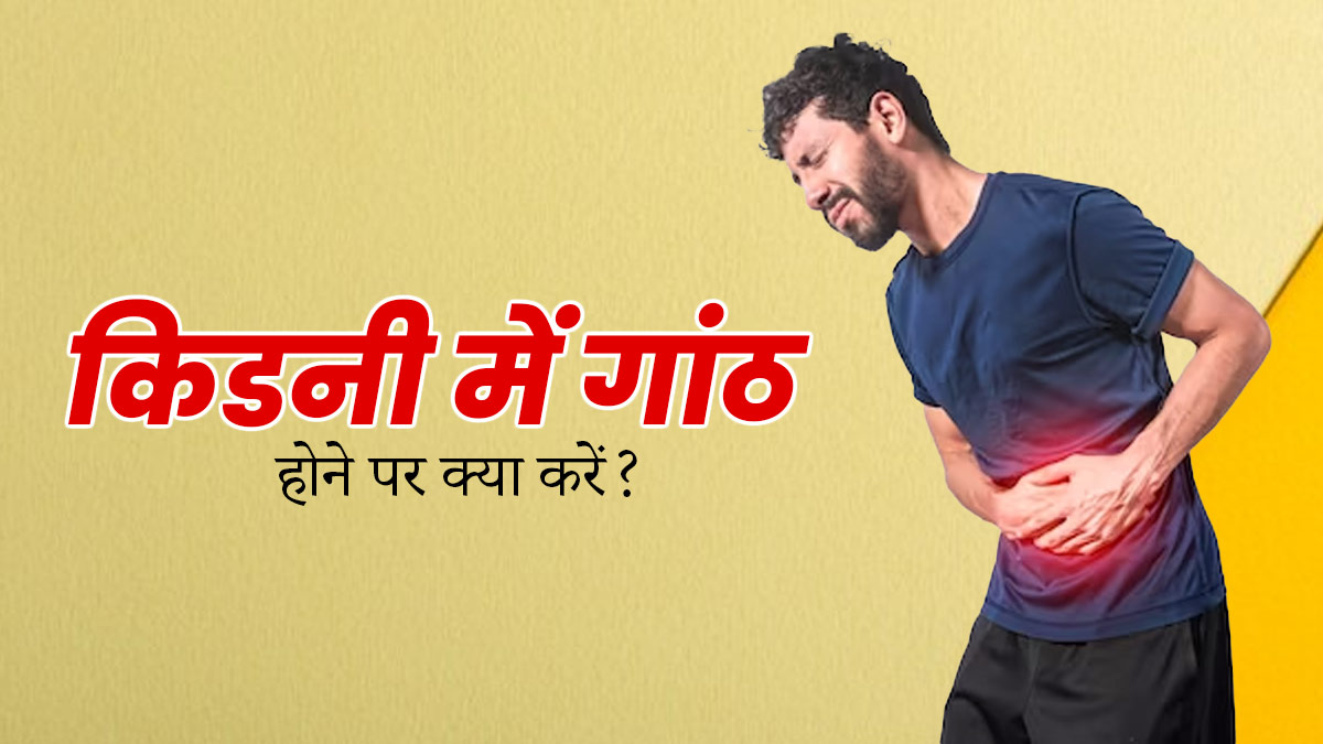 Kidney Cyst: किडनी में गांठ होने पर क्या करें? जानें 4 उपाय
