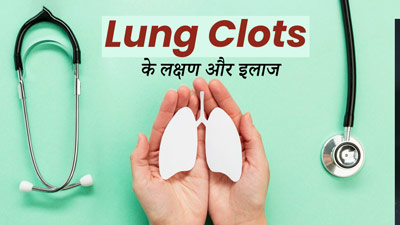 Lung Clots के कारण भी हो सकता है छाती में दर्द, डॉक्टर से जानें बचाव के उपाय