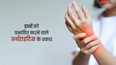 घुटनों में ही नहीं, हाथ की कलाई और उंगलियों में भी हो सकता है अर्थराइटिस, जानें इसके प्रकार के बारे में 