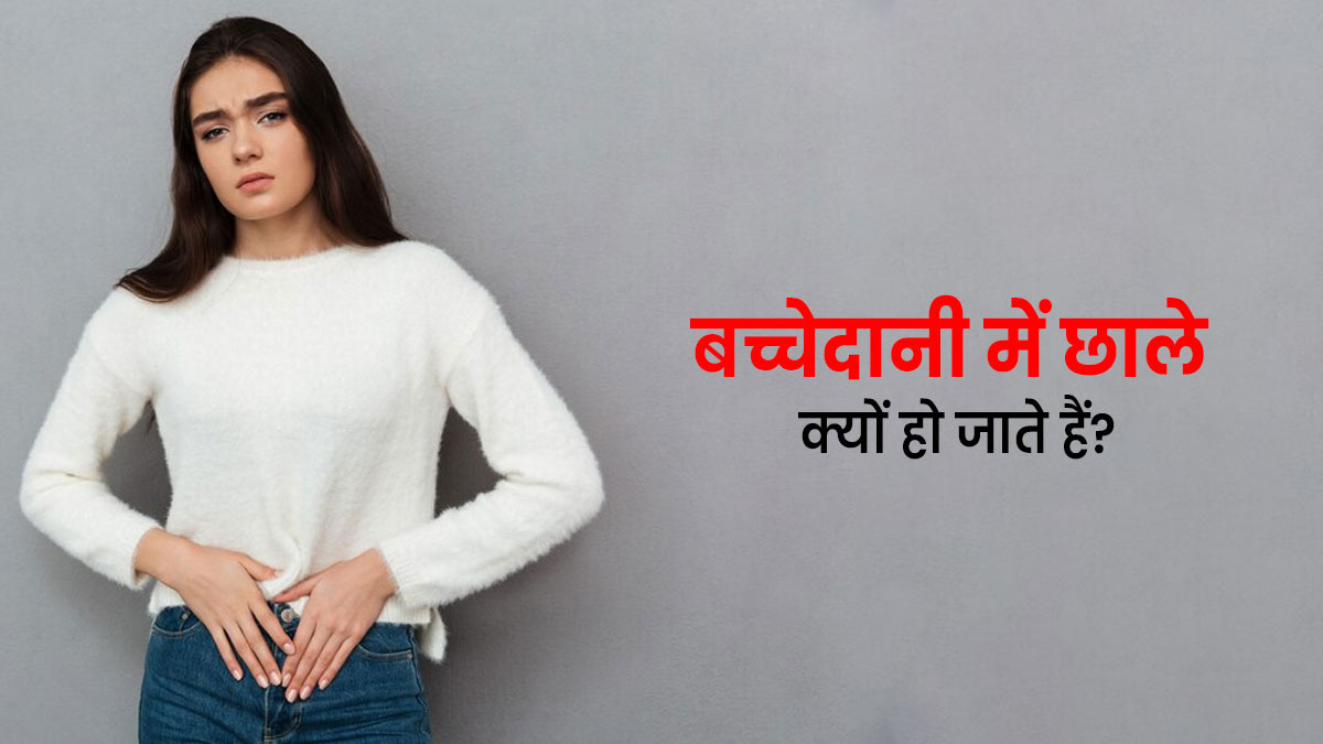 बच्चेदानी में छाले क्यों हो जाते हैं? जानें इसके 3 कारण