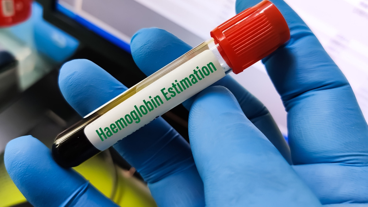 Low On Haemoglobin Expert Explains Role Of Haemoglobin And What Causes   Haemoglobin 