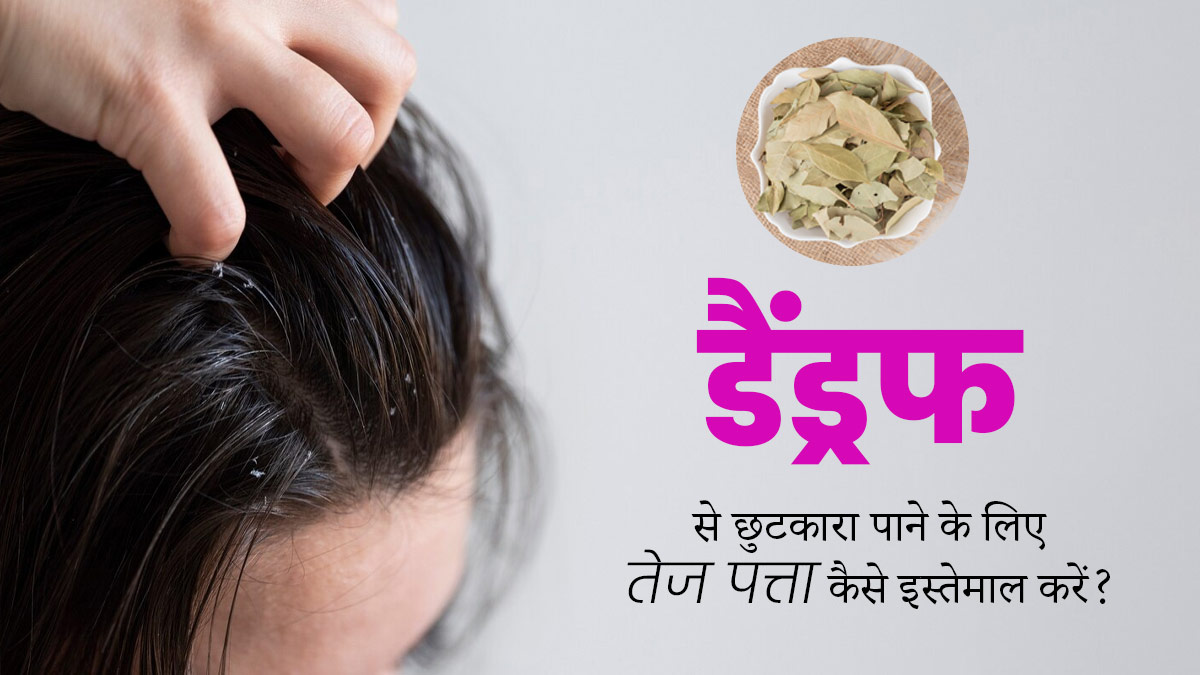 डैंड्रफ से छुटकारा दिलाने में मदद कर सकता है तेज पत्ता, जानें इस्तेमाल का सही तरीका