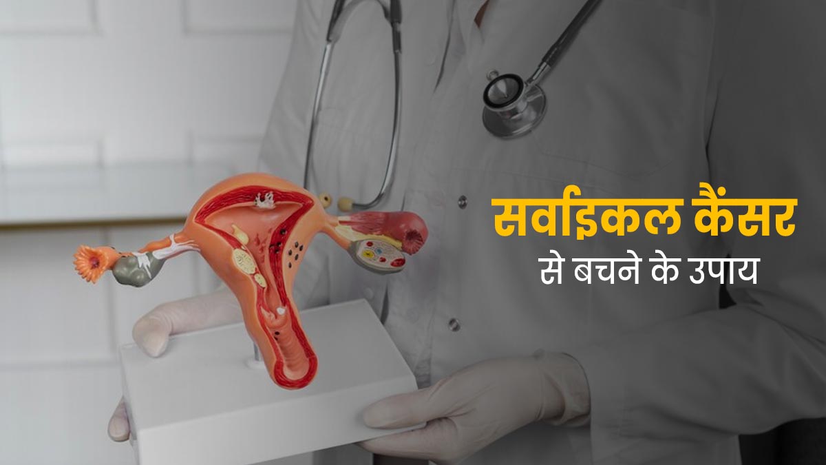 सर्वाइकल कैंसर के जोखिम को कम करने के लिए अपनाएं ये 5 उपाय, होगा बचाव
