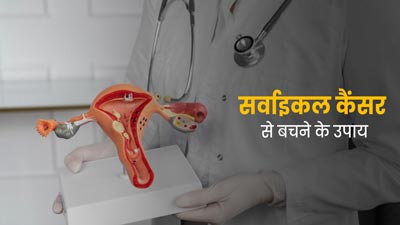 सर्वाइकल कैंसर के जोखिम को कम करने के लिए अपनाएं ये 5 उपाय, होगा बचाव