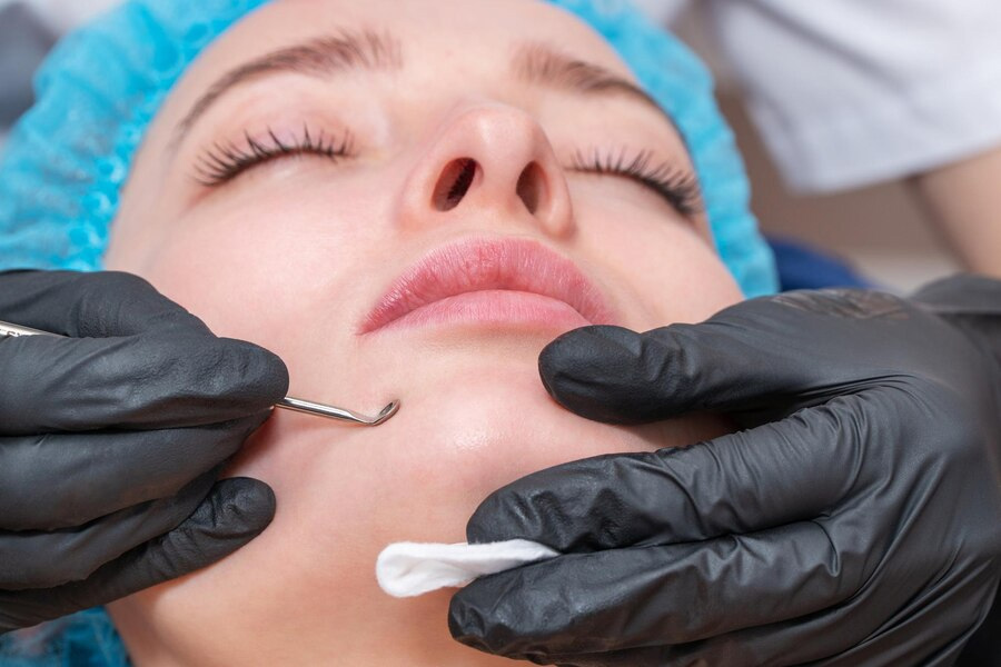 Worst Ways To Remove Blackheads