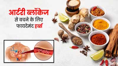 आर्टरी ब्लॉकेज से बचने के लिए करें इन हर्ब्स का सेवन, हार्ट की बीमारी का कम होगा खतरा