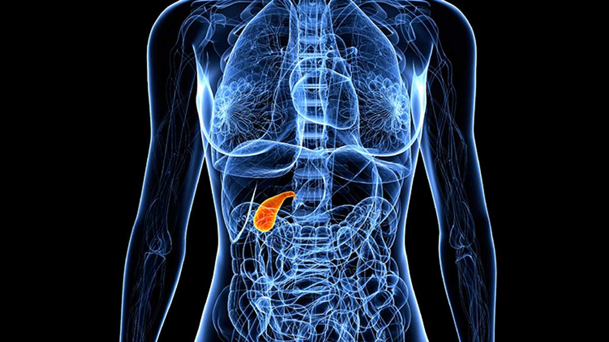 Gallbladder Cancer: Expert Reveals 7 Facts You Must Know Of | OnlyMyHealth