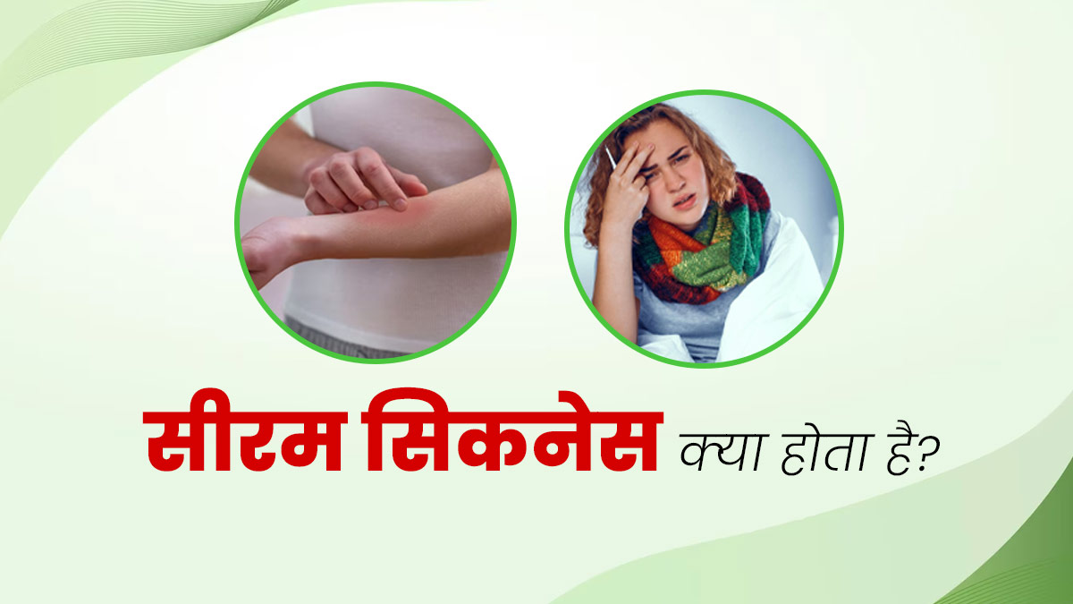 Serum Sickness: सीरम सिकनेस होने पर नजर आते हैं रैशेज और बुखार जैसे लक्षण, जानें इसका कारण और इलाज