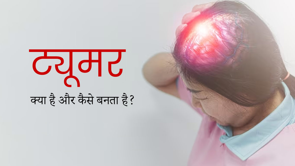 Tumor क्या होता है? डॉक्टर से जानें शरीर के अलग-अलग हिस्सों में कैसे बनता है ट्यूमर